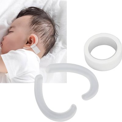 چسب گوش نوزاد